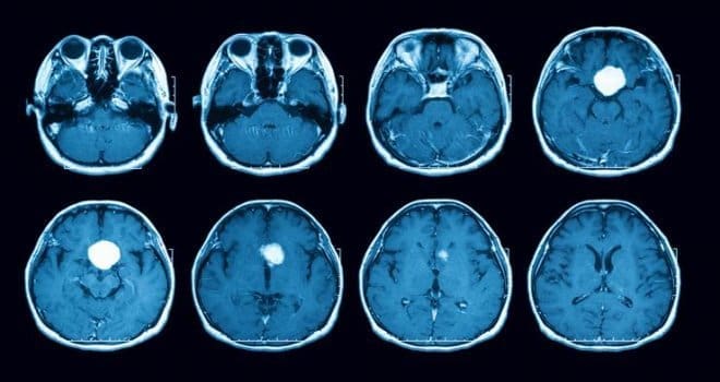AI uspio pročitati naše misli iz skenova mozga, pojavili se etički problemi