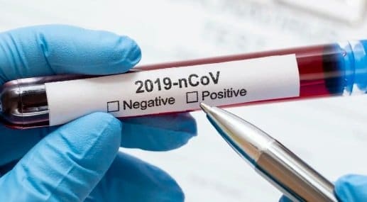 Sjednica kriznog štaba: Raste broj zaraženih od Covid-19, kliničke slike blaže