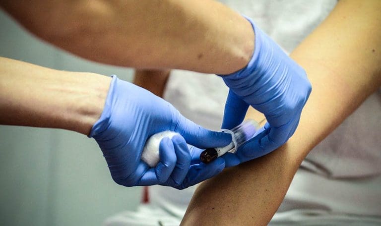 U Zagrebu vlada epidemija hepatitisa A: Saznajte više informacija o “bоlеsti prljаvih ruku”