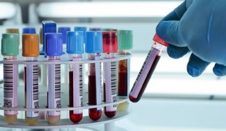 Djeca “zamorčići” dobijala krv zaraženu HIV-om: Većina njih koji su bili podvrgnuti ovim ispitivanjima danas je mrtva