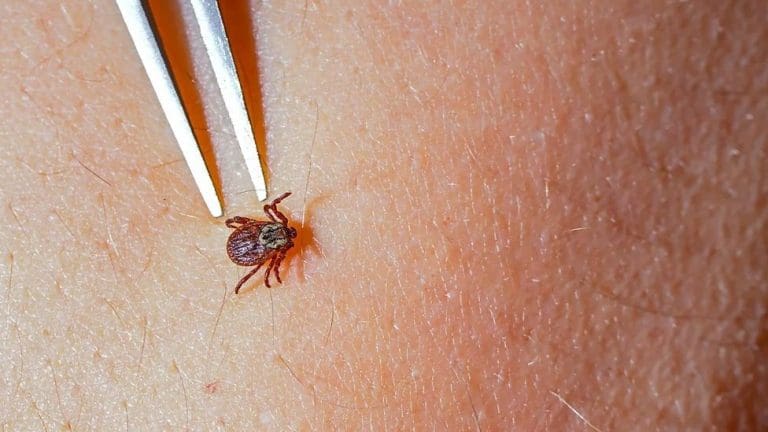 Stručnjaci upozoravaju: Krpelj prenosnik brojnih bolesti, oprezno ga odstraniti